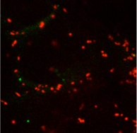 confocal imaging mRNA trafficking